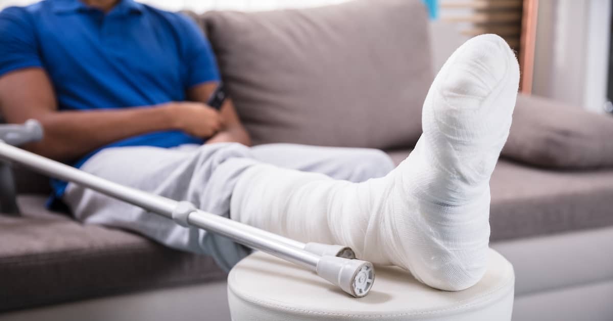 man with broken leg and crutches resting injured leg on a stool